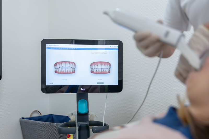 診断・治療計画の提案